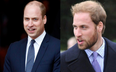 威廉王子「受夠禿頭被嘲笑」！狠砸7000元「打造自信髮型」亮相！被網友讚翻：有guts