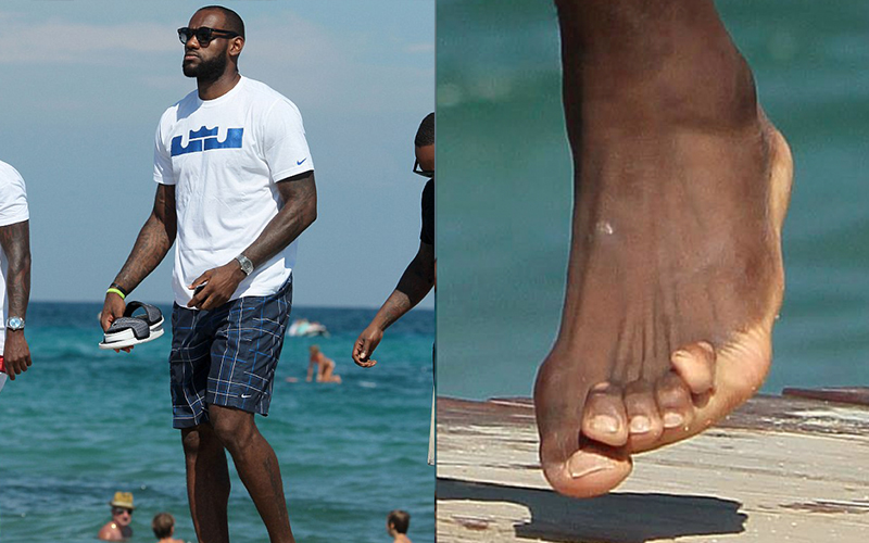 NBA明星球鞋底下的痛！詹皇露出嚴重運動傷害的「扭曲腳趾」粉絲驚：怎麼會這樣？　